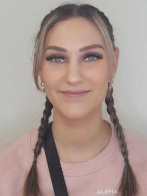 Female Face Before Filler Treatment in Bonney Lake, WA | Honey Glow Health, Female Face Before Filler Treatment in Bonney Lake, WA | Honey Glow Health,