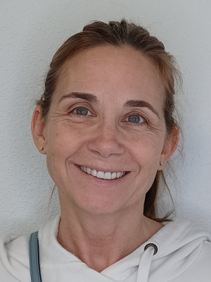 Mid-aged female happy face before Laser Treatment in Bonney Lake, WA | Honey Glow Health,