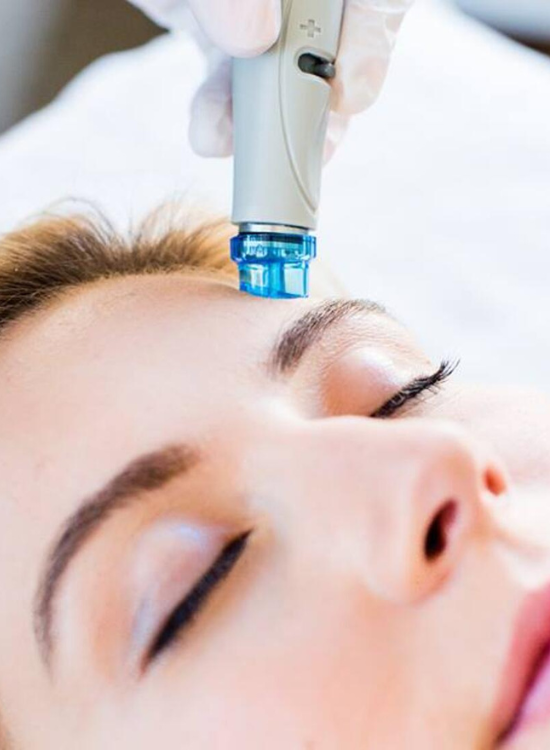 A Female Getting Skinwave Aqua Facial through device on forehead | Honey Glow Health in Bonney Lake, WA