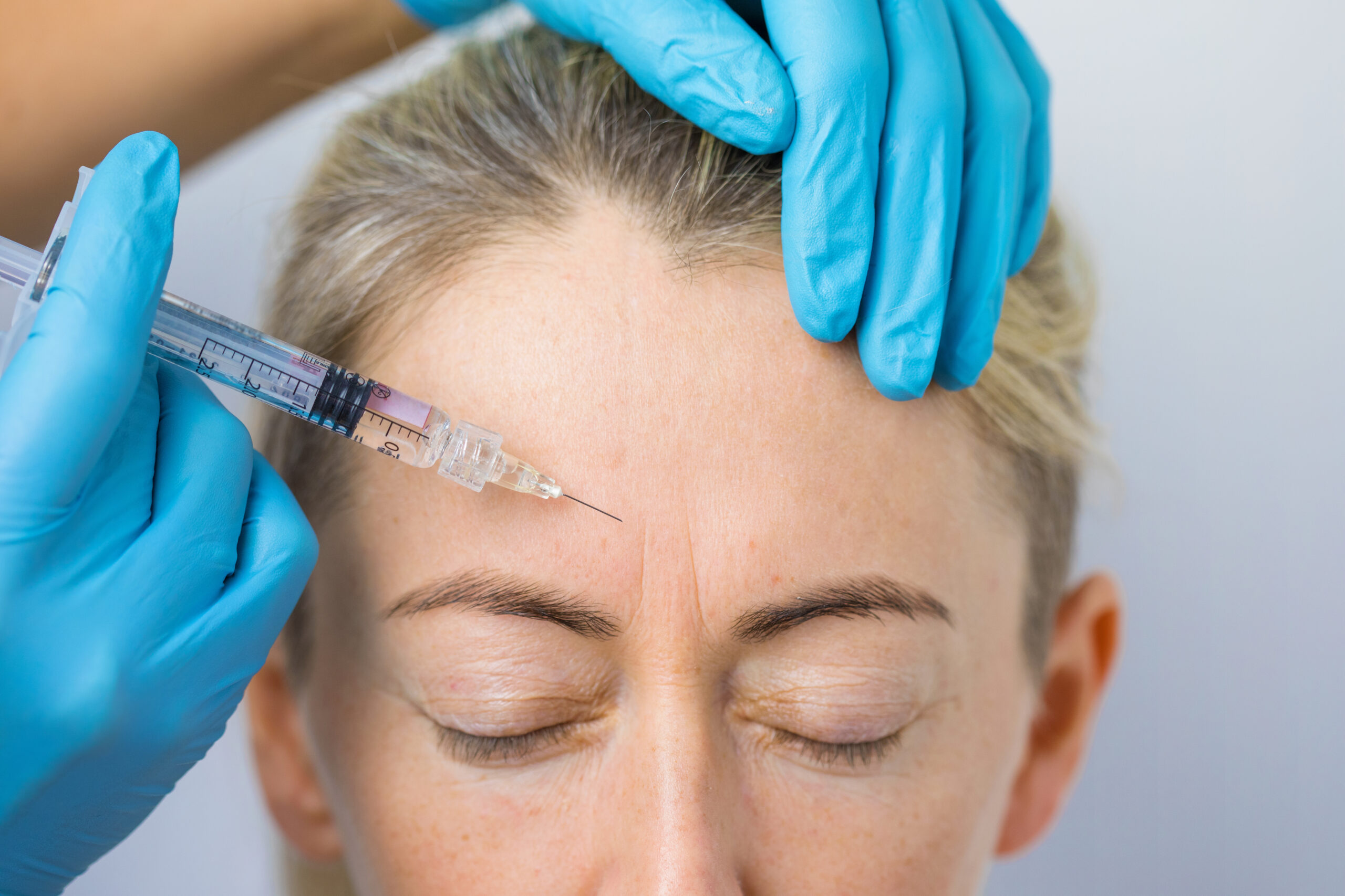 The Transformative Effects of Botox: Unveiling the Fountain of Youth