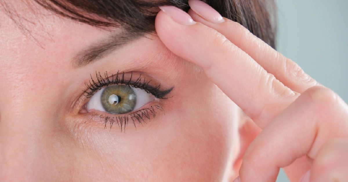 Eye Area Showing Droopy Eyelids And Signs Of Aging by Honey Glow Health in Bonney Lake, WA