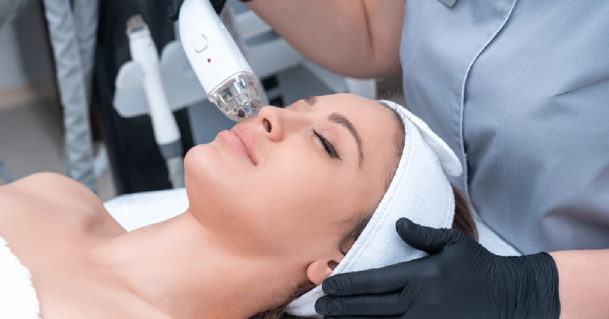 Professional Laser Treatment to Improve Acne Scars by Honey Glow Health in Bonney Lake, WA